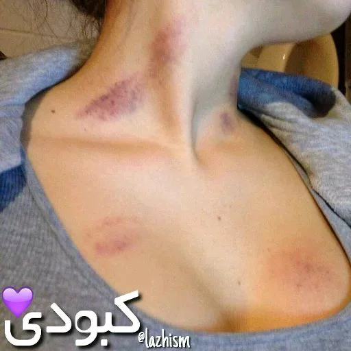 ❤️نرگــــس💍حســــن💜 sticker 9