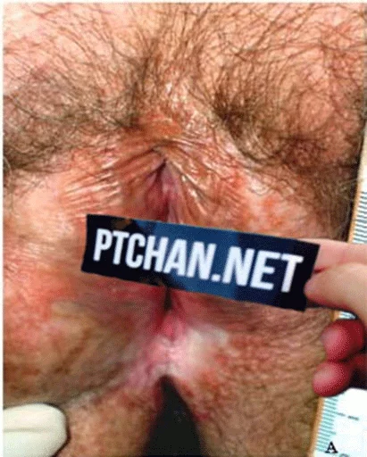 NicoPack sticker 9