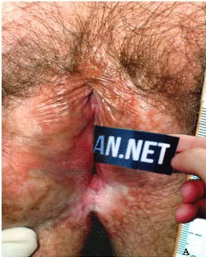 NicoPack sticker 10